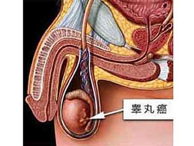 癌症,肿瘤,癌症治疗,癌症预防,肿瘤医院
