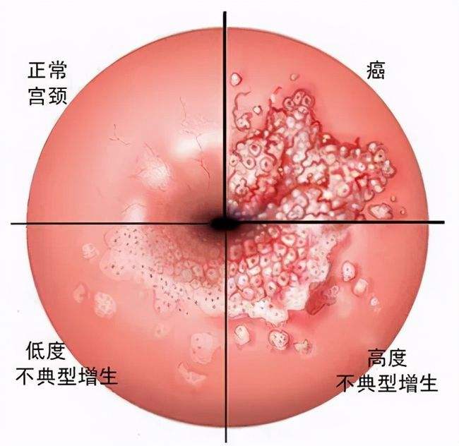 九种常见癌症的病因、症状及预防汇总