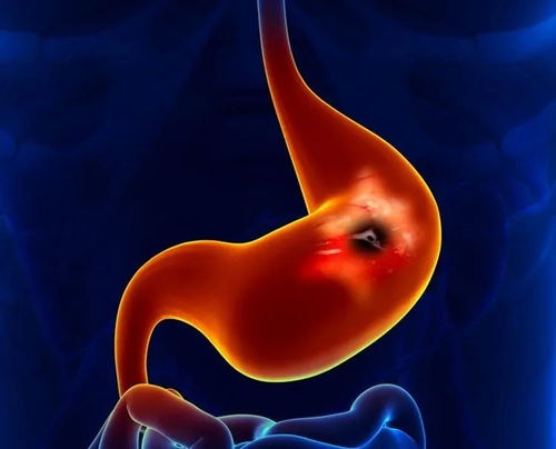 üͷ�Ϸ���������ô��