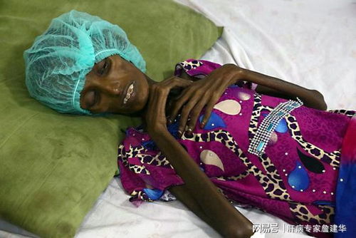 肿瘤标志物一定是恶性吗 肿瘤标志物一定是恶性吗