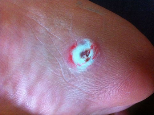 ���������������ö���