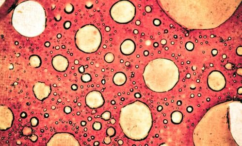 原发性脑肿瘤是良性的吗 原发性脑肿瘤是良性的吗