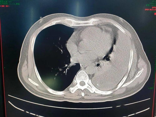 ʳ���������ʵϰ����