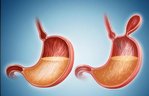 肿瘤对身高的影响有哪些 肿瘤对身高的影响有哪些