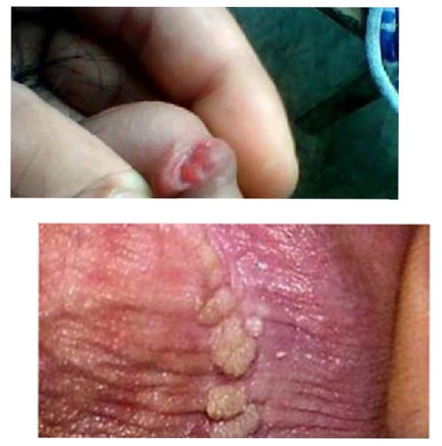 安置帮教(安置帮教期) 安置帮教(安置帮教期)