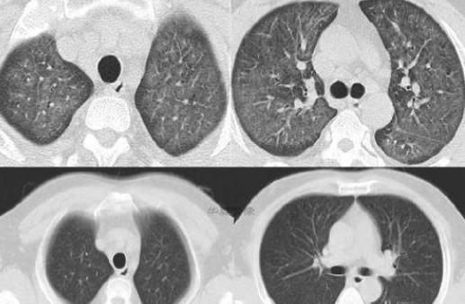 ����Ӣ�� �ռ䲼��Ӣ��