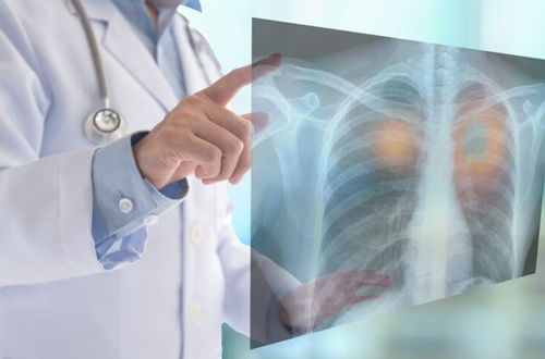 肿瘤未发病前可以化疗吗 肿瘤未发病前可以化疗吗