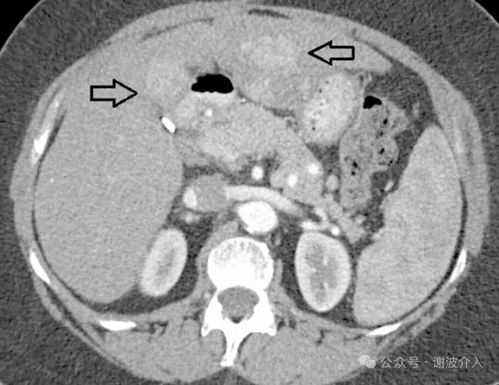 暗夜猎手薇恩 暗夜猎手薇恩原图 暗夜猎手薇恩 暗夜猎手薇恩原图