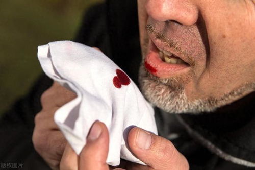 mt�������������Ƕ���