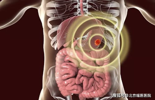 ������ɢ���ƹ�ʲô����