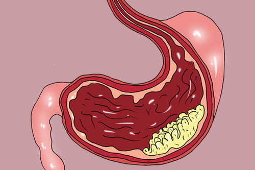 ���������س̶Ȼ���Ϊ