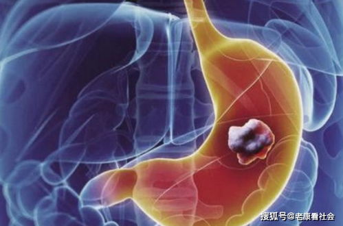 ����������ʲô�����