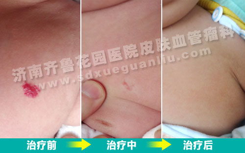 ʲô��ʳ��Ԥ������ת��