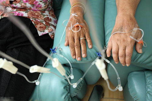 脑肿瘤3点9公分严重吗 脑肿瘤3点9公分严重吗