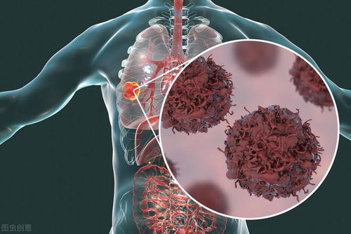 乙状结肠肿瘤能摸到吗 乙状结肠肿瘤能摸到吗