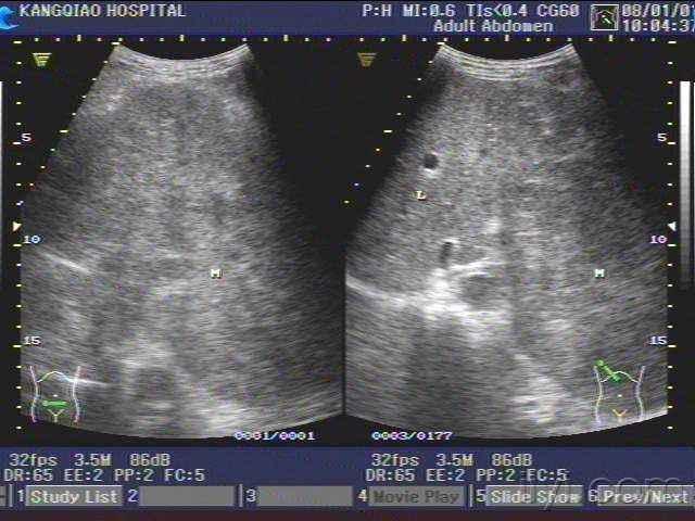 曾黎是哪里人 曾黎是谁家艺人 曾黎是哪里人 曾黎是谁家艺人