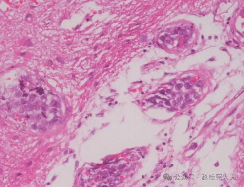 �°��������� �°�����