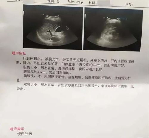 脚筋突出和肿瘤有关系吗 脚筋突出和肿瘤有关系吗