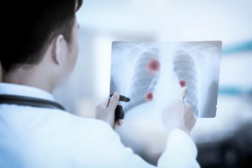 腹部dr能检查肠道肿瘤 腹部dr能检查肠道肿瘤