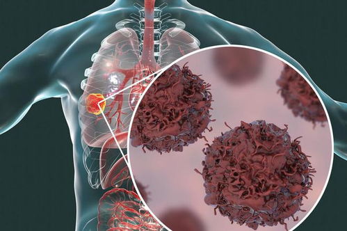 �����ɶ���_��ҵ�ߵ�Ӱ�����ɶ���