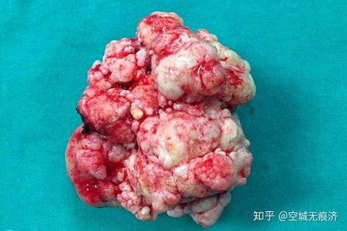 ����������(����������������Ƭ)