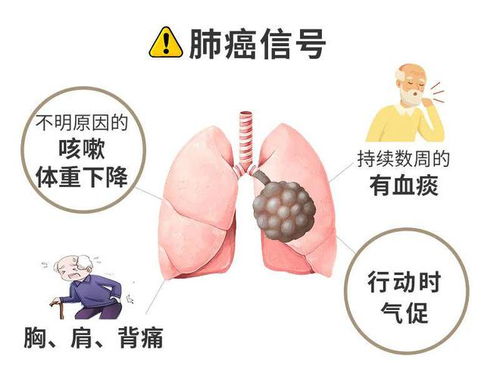 �ӹ�ƫ����������ô����