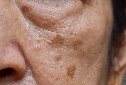 直肠肿瘤手术多少天排气 直肠肿瘤手术多少天排气