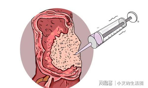 ��Ҳ�ĸ��� ��Ҳ�ĸ�����������