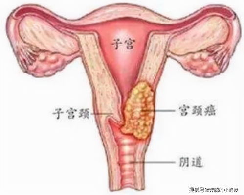 �����������ʳ���������