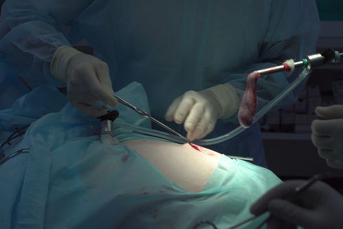 丘脑肿瘤有没有良性的 丘脑肿瘤有没有良性的