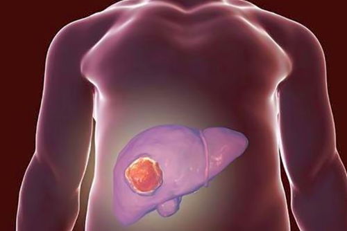 ��������ϸ����Ⱦ����