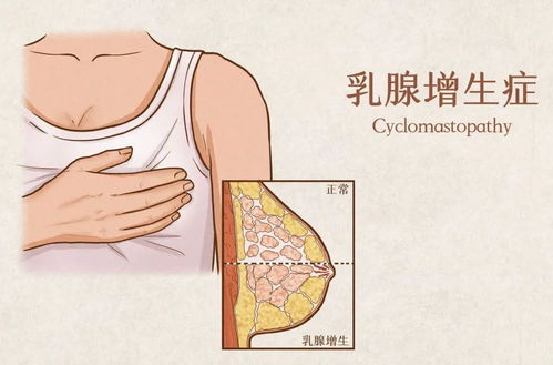 肿瘤的多学科治疗 肿瘤多学科治疗MDT 肿瘤的多学科治疗 肿瘤多学科治疗MDT
