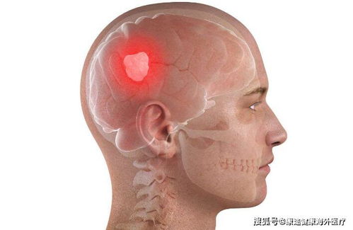 消化道肿瘤防治中心无锡 消化道肿瘤防治中心无锡