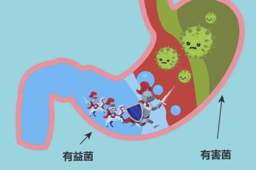 肠道有肿瘤会引起头痛吗 肠道有肿瘤会引起头痛吗