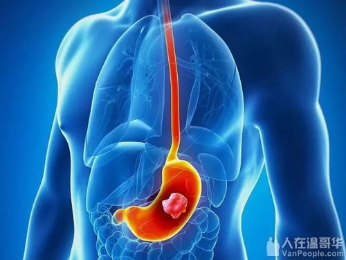 �ܰ���������ʲôˮ����