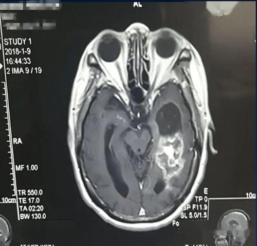 中国最好的肿瘤中医院 中国最好的肿瘤中医院
