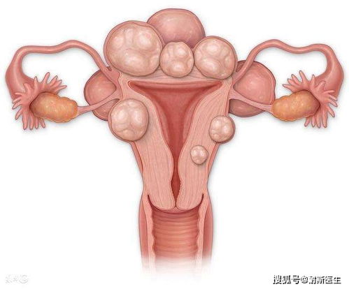 ����������һ���ʲô