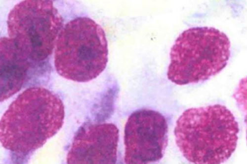 �ӹ�������ʳע��ʲô