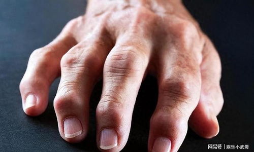 ��������ҽԺר�� ��������ҽԺר�Ҽ��