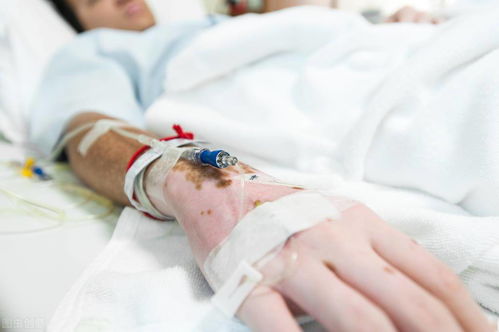 �и��������޸����� �и�����ֲ������Щ