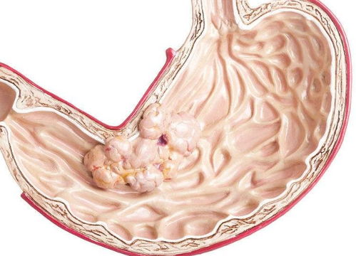 山西肿瘤研究所名册在哪 山西肿瘤研究所名册在哪