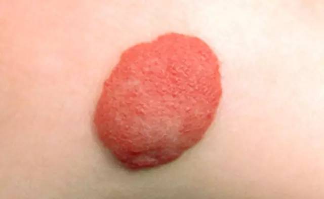 我国已经进入拉尼娜状态 拉尼娜状态会导致冬天更冷吗 我国已经进入拉尼娜状态 拉尼娜状态会导致冬天更冷吗