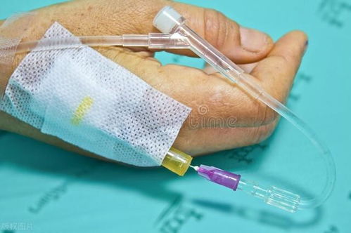 脑袋里长肿瘤是为什么呢 脑袋里长肿瘤是为什么呢