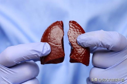 脑肿瘤压迫神经的症状 脑肿瘤压迫神经的症状