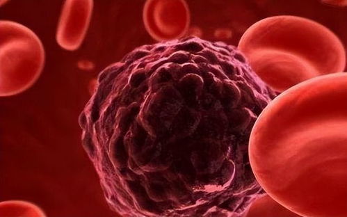 菏泽不是肿瘤 菏泽有肿瘤医院吗 菏泽不是肿瘤 菏泽有肿瘤医院吗