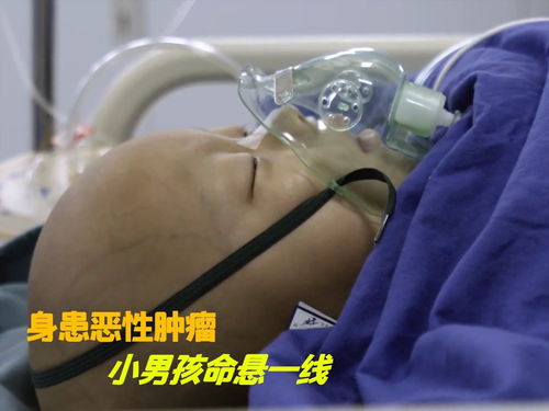 ������Ҫע��ʲô����