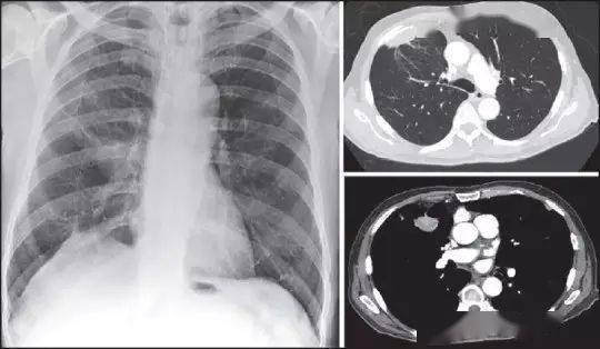 ­��ʲô�����������