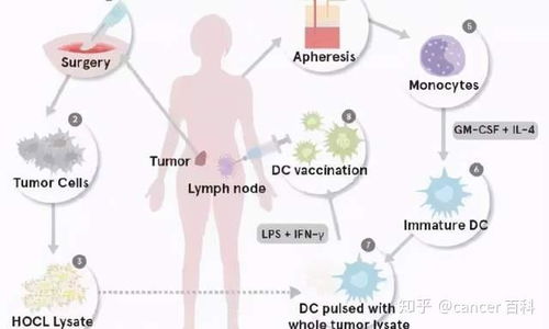 骨扫描能否确定骨肿瘤 骨扫描能否确定骨肿瘤