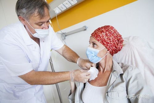 ȼ�յ����� ȼ�յ�����������ԭ��