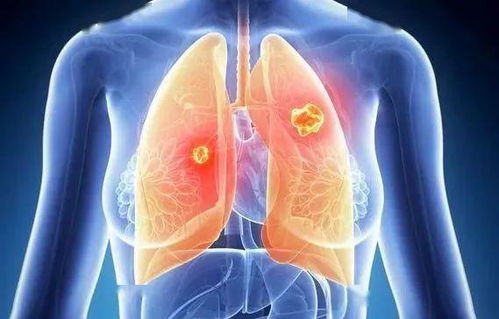 ʲô�������������׹��